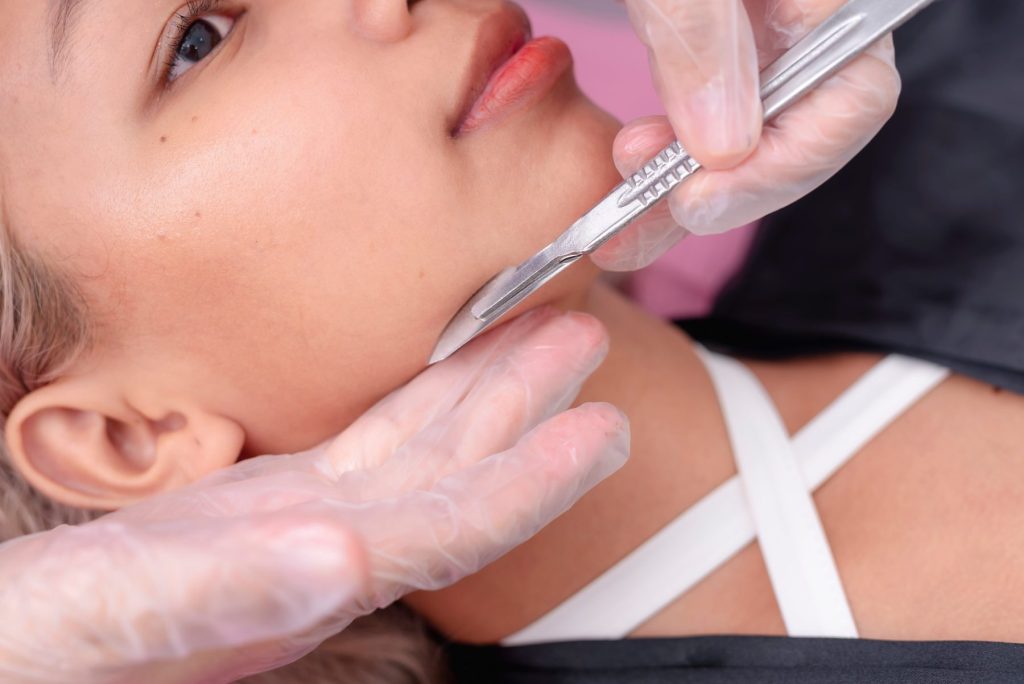 Photo - A woman getting dermalplaning treatment